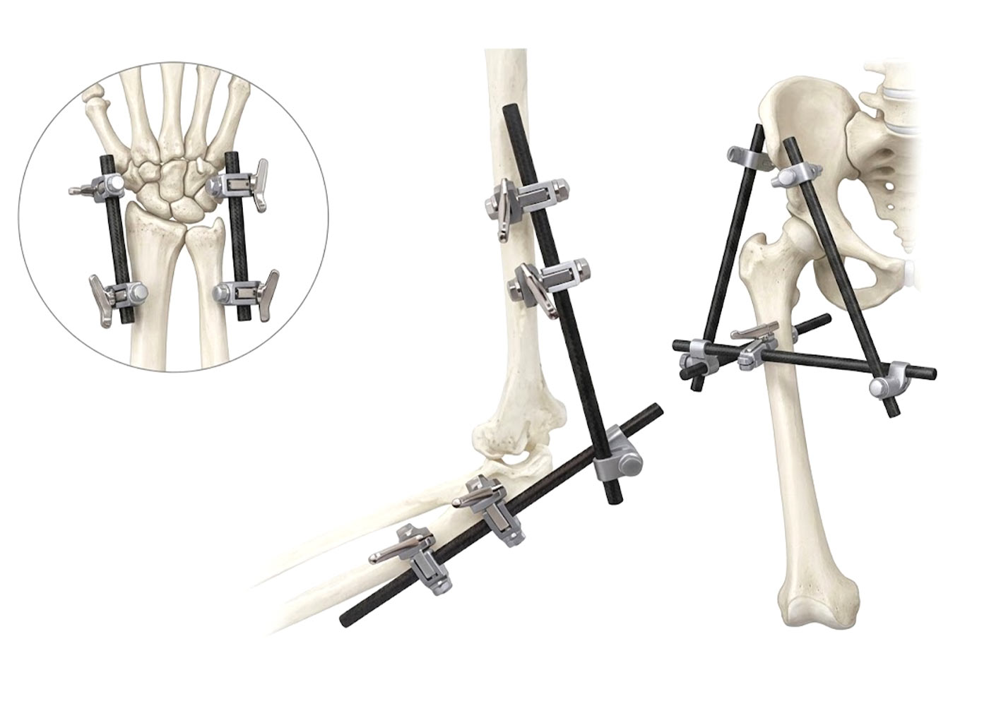 Healthcare & Orthopaedics